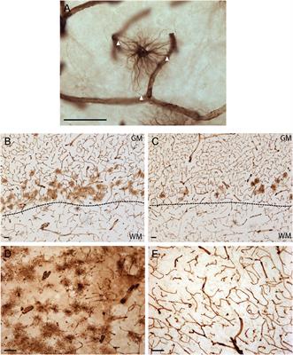 Characterization of Vimentin-Immunoreactive Astrocytes in the Human Brain